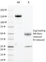 HLA-DRA (MHC II) Antibody in SDS-PAGE (SDS-PAGE)