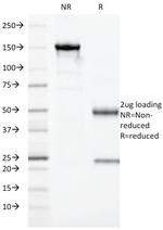 HLA-DRA (MHC II) Antibody in SDS-PAGE (SDS-PAGE)