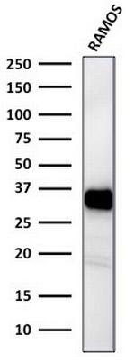 HLA-DR (MHC II) Antibody in Western Blot (WB)