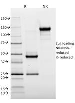 HLA-DR (MHC II) Antibody in SDS-PAGE (SDS-PAGE)