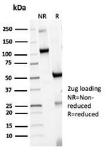 HLA-DR (MHC II) Antibody in SDS-PAGE (SDS-PAGE)