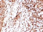 HLA-DR (MHC II) Antibody in Immunohistochemistry (Paraffin) (IHC (P))