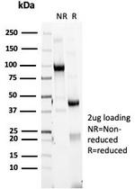 HLA-DR (MHC II) Antibody in SDS-PAGE (SDS-PAGE)