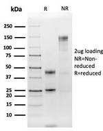 HLA-DRB (MHC II) Antibody in SDS-PAGE (SDS-PAGE)