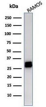 HLA-DRB (MHC II) Antibody in Western Blot (WB)