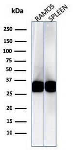 HLA-DRB (MHC II) Antibody in Western Blot (WB)