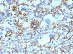 HLA-DRB (MHC II) Antibody in Immunohistochemistry (Paraffin) (IHC (P))