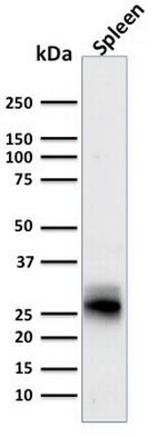 HLA-DRB (MHC II) Antibody in Western Blot (WB)