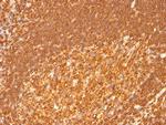 HLA-DRB (MHC II) Antibody in Immunohistochemistry (Paraffin) (IHC (P))