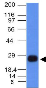 HLA-DRB (MHC II) Antibody in Western Blot (WB)