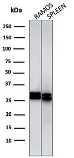 HLA-DRB (MHC II) Antibody in Western Blot (WB)