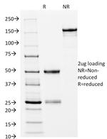 HLA-DRB (MHC II) Antibody in SDS-PAGE (SDS-PAGE)