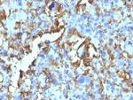 HLA-DRB (MHC II) Antibody in Immunohistochemistry (Paraffin) (IHC (P))