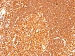 HLA-DRB (MHC II) Antibody in Immunohistochemistry (Paraffin) (IHC (P))