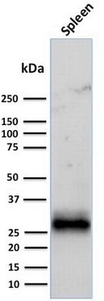 HLA-DRB (MHC II) Antibody in Western Blot (WB)