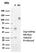 HLA-DRB (MHC II) Antibody in SDS-PAGE (SDS-PAGE)