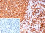 HLA-DRB (MHC II) Antibody in Immunohistochemistry (Paraffin) (IHC (P))