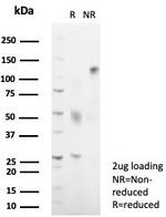 HLA-DRB (MHC II) Antibody in SDS-PAGE (SDS-PAGE)