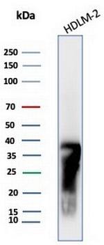 HLA-DRB (MHC II) Antibody in Western Blot (WB)