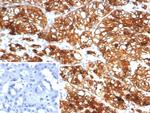 HLA-G (Major Histocompatibility Complex, class I, G) Antibody in Immunohistochemistry (Paraffin) (IHC (P))