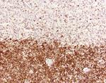 Mouse IgG (H+L) Secondary Antibody in Immunohistochemistry (Paraffin) (IHC (P))