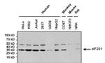 Mouse IgG (H+L) Secondary Antibody in Western Blot (WB)