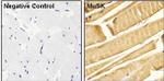 Rabbit IgG (H+L) Secondary Antibody in Immunohistochemistry (Paraffin) (IHC (P))