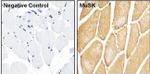 Rabbit IgG (H+L) Secondary Antibody in Immunohistochemistry (Paraffin) (IHC (P))