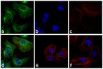 Rabbit IgG (H+L) Cross-Adsorbed Secondary Antibody in Immunocytochemistry (ICC/IF)