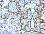 CD168/RHAMM Antibody in Immunohistochemistry (Paraffin) (IHC (P))