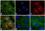 Rat IgG (H+L) Secondary Antibody in Immunocytochemistry (ICC/IF)