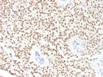 FOXA1/HNF3A Antibody in Immunohistochemistry (Paraffin) (IHC (P))