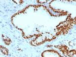 FOXA1/HNF3A Antibody in Immunohistochemistry (Paraffin) (IHC (P))