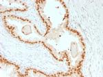 FOXA1/HNF3A Antibody in Immunohistochemistry (Paraffin) (IHC (P))