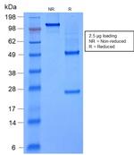 FOXA1/HNF3A Antibody in SDS-PAGE (SDS-PAGE)