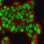 FOXA1/HNF3A Antibody in Immunocytochemistry (ICC/IF)