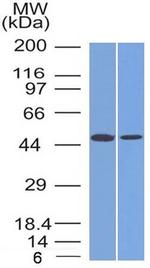 FOXA1/HNF3A Antibody in Western Blot (WB)