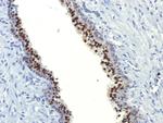 FOXA1/HNF3A Antibody in Immunohistochemistry (Paraffin) (IHC (P))