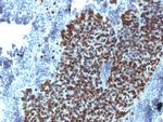 FOXA1/HNF3A Antibody in Immunohistochemistry (Paraffin) (IHC (P))