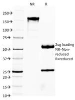 FOXA1/HNF3A Antibody in SDS-PAGE (SDS-PAGE)