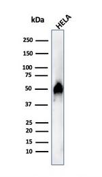 FOXA1/HNF3A Antibody in Western Blot (WB)