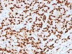 FOXA1/HNF3A Antibody in Immunohistochemistry (Paraffin) (IHC (P))