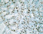 Claudin 2 Antibody in Immunohistochemistry (IHC)