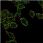 HOXB2 (Transcription Factor) Antibody in Immunocytochemistry (ICC/IF)