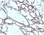 HOXB2 (Transcription Factor) Antibody in Immunohistochemistry (Paraffin) (IHC (P))