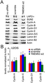 Cyclin E Antibody in Western Blot (WB)