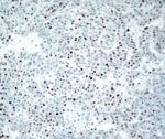 Cyclin E Antibody in Immunohistochemistry (IHC)