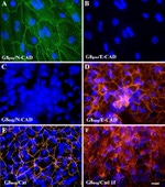 CDH11 Antibody in Immunocytochemistry (ICC/IF)