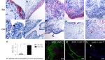 CDH11 Antibody in Immunohistochemistry (Paraffin) (IHC (P))