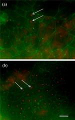 Acetyl-alpha Tubulin (Lys40) Antibody in Immunocytochemistry (ICC/IF)